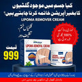 Lipoma Removal Cream | Special Price Offer